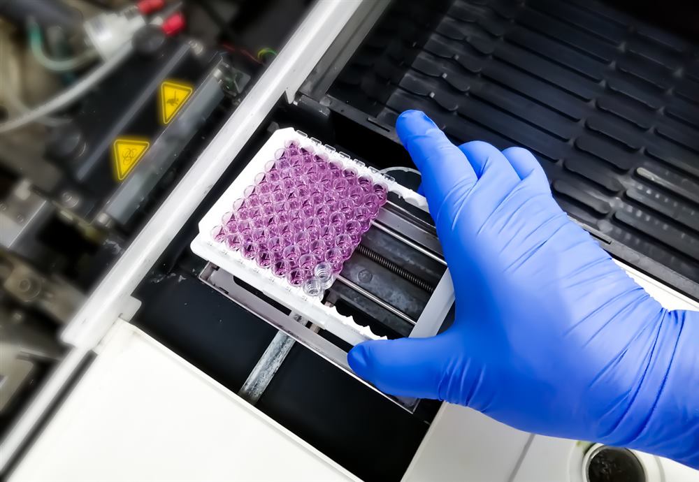 Diagnostic analyzer equipment in use